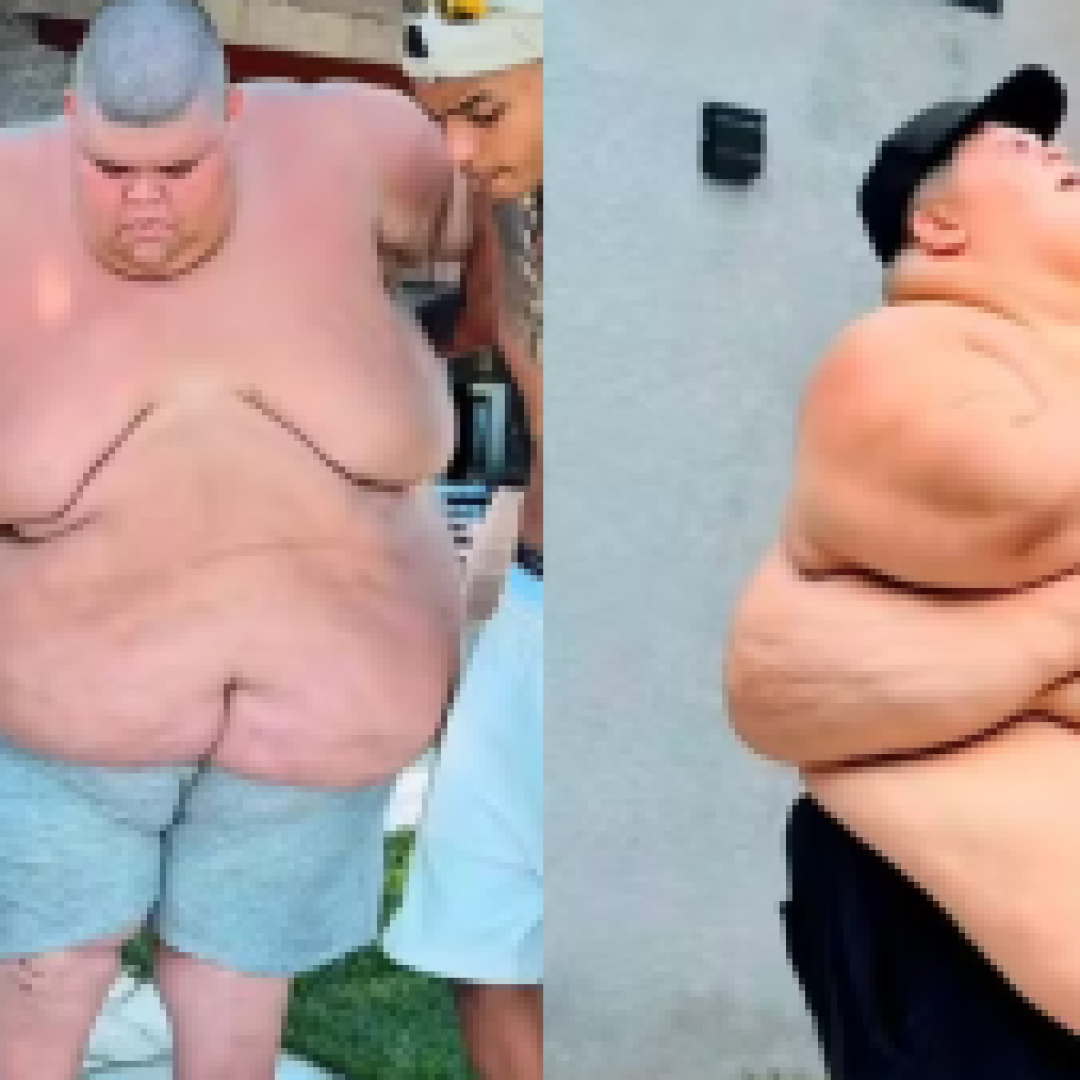 Gordao-da-XJ-perde-mais-de-115kg-e-agora-pode.png